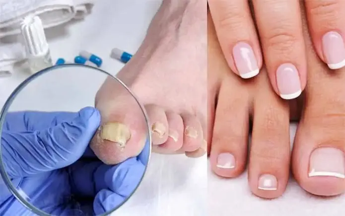 before and after results